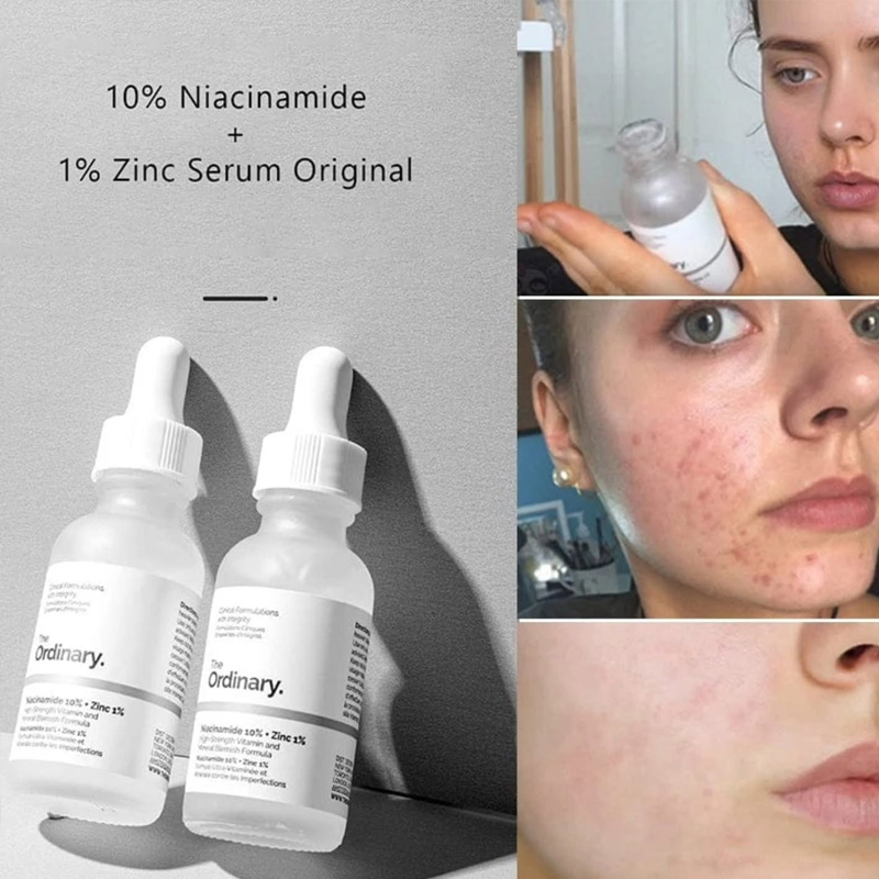 The Ordinary Niacinamide 10% + - Luxury Skincare Brands ulasan dan harga